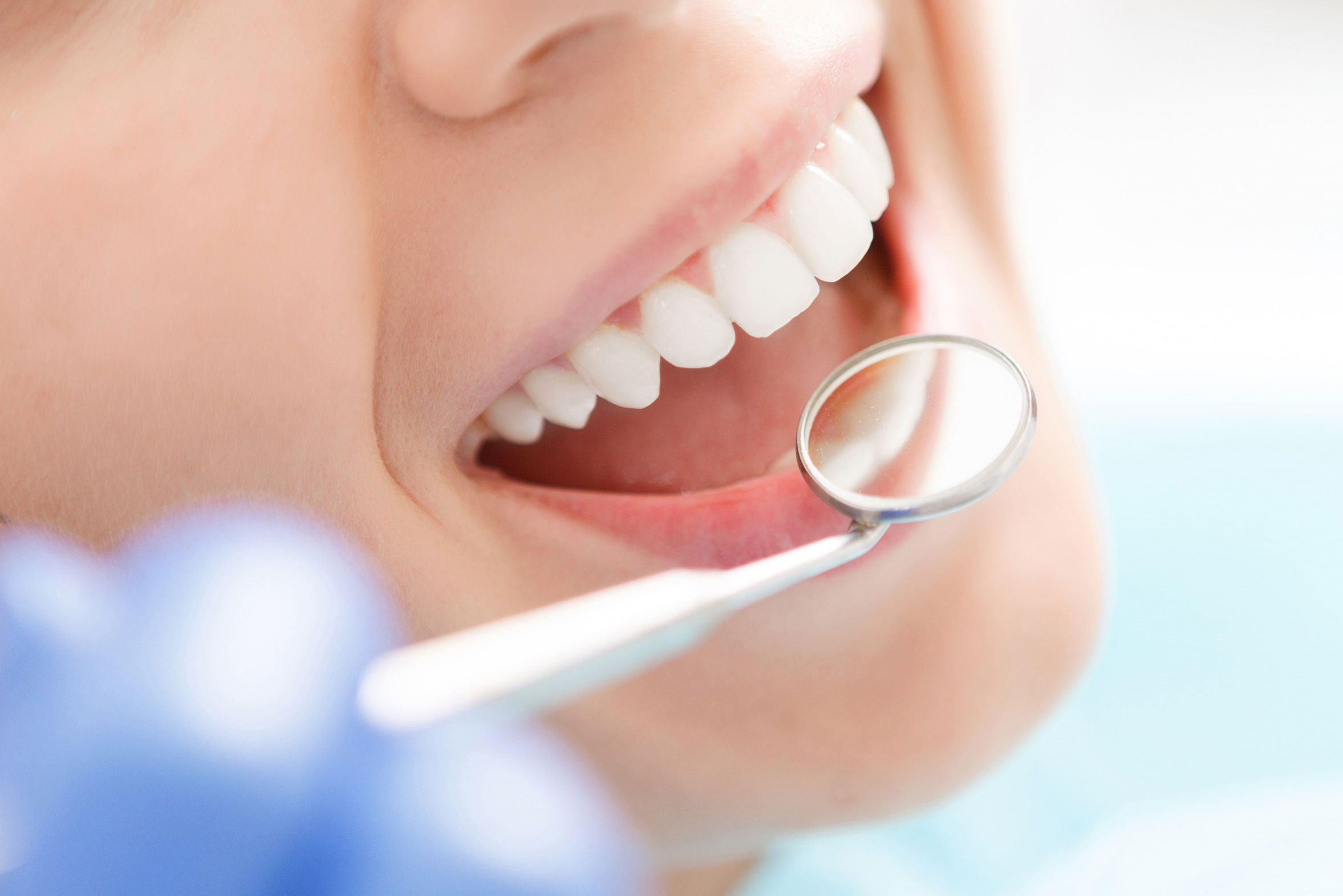 Zahnarzt untersucht Zähne Meller_Zahngesundheit_Home_Slider_Fotolia_85924650_L-wide.jpg